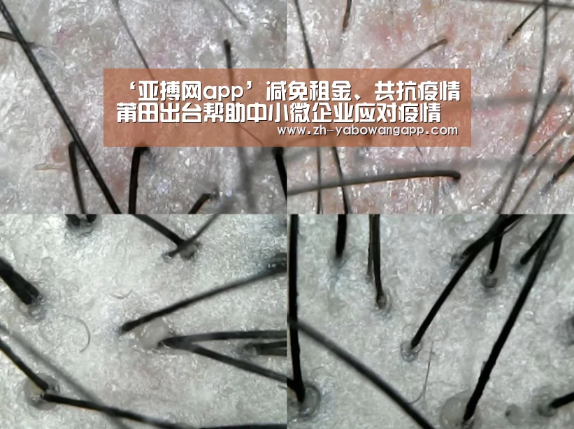 ‘亚搏网app’减免租金、共抗疫情莆田出台帮助中小微企业应对疫情共度难关若干措施